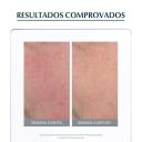 Creme Hidratante Facial Eucerin Anti Redness FPS25 com 50ml
