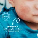 Hidratante Infantil Mustela Bebê Stelatopia Creme Emoliente para Pele Atópica 200ml