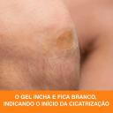 Curativo 3M Nexcare Cicatrização Avançada com 6 unidades