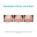 ISDIN HIDRATANTE PARA OS PéS CREME UREIA 75GML