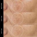 LANCôME RéNERGIE H.P.N 300-PEPTIDES CREME FACIAL ANTI-IDADE 50ML