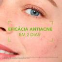 SEBIUM KERATO+ BIODERMA GEL CREME 30ML